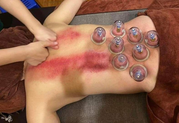 Gừng Spa Quảng Ngãi cam kết mang đến cho bạn hiệu quả rõ rệt sau mỗi liệu trình 